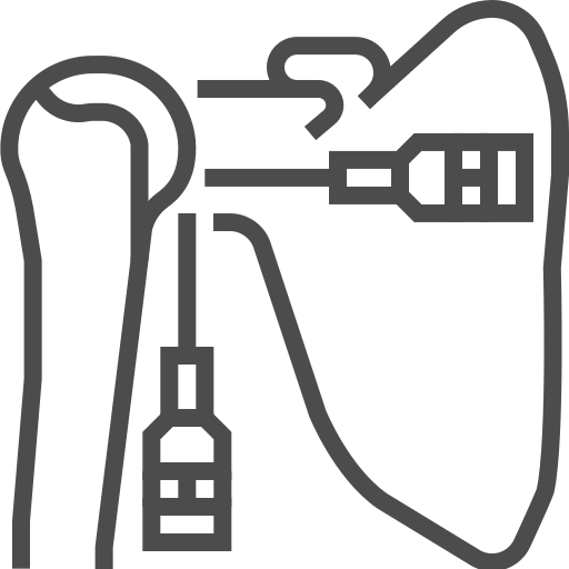 Shoulder Arthroscopy